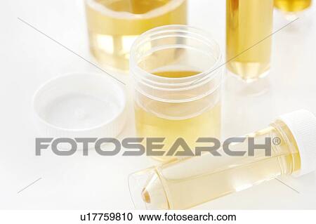 Urine samples for analysis, studio shot. View Large Photo Image Stock Image - Urine samples for analysis, studio shot.. Fotosearch