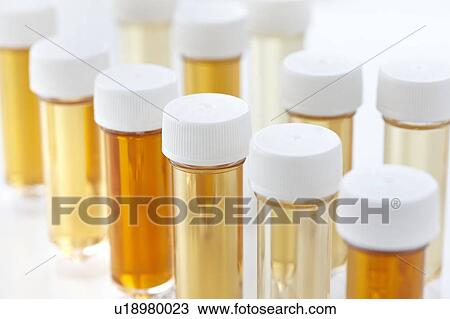 Stock Image - Urine samples for analysis, studio shot.. Fotosearch