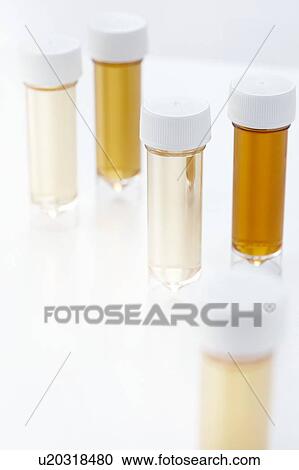Stock Image - Urine samples for analysis, studio shot.. Fotosearch