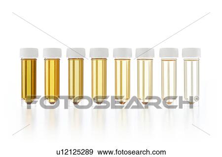 Stock Photo - Urine samples for analysis, studio shot.. Fotosearch