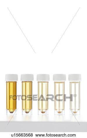 Stock Photo - Urine samples for analysis, studio shot.. Fotosearch