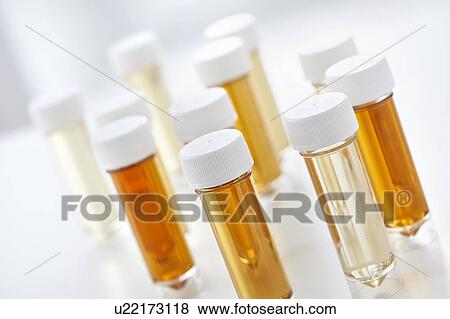 Stock Photo - Urine samples for analysis, studio shot.. Fotosearch