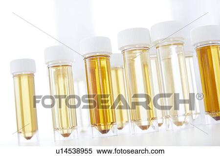 Urine samples for analysis, studio shot. View Large Photo Image Stock Photography - Urine samples for analysis, studio shot.. Fotosearch