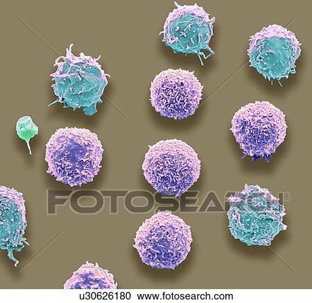 Stock Image - White blood cells and a platelet. Coloured scanning electron micrograph (SEM) of white blood cells and a single platelet (green, small). Platelets are fragments of white blood cells that under normal circumstances are small and biconcave in form..... Fotosearch