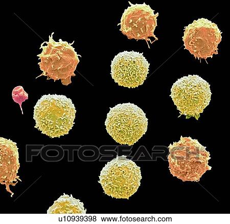 White blood cells and a platelet. Coloured scanning electron micrograph (SEM) of white blood cells and a single platelet (red). Platelets are fragments of white blood cells that under normal circumstances are small and biconcave in form. However, if... View Large Photo Image Stock Photo - White blood cells and a platelet. Coloured scanning electron micrograph (SEM) of white blood cells and a single platelet (red). Platelets are fragments of white blood cells that under normal circumstances are small and biconcave in form. However, if.... Fotosearch