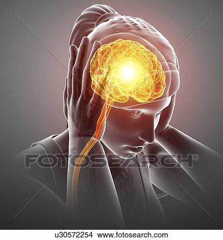 Woman having headache migraine. View Large Photo Image Picture - Woman having headache migraine.. Fotosearch