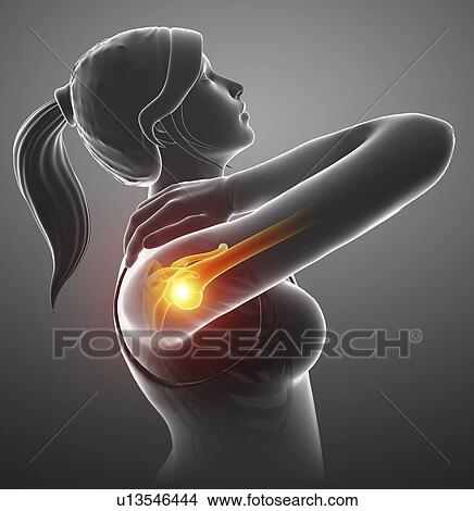 Woman with a painful shoulder, computer illustration. View Large Photo Image Picture - Woman with a painful shoulder, computer illustration.. Fotosearch