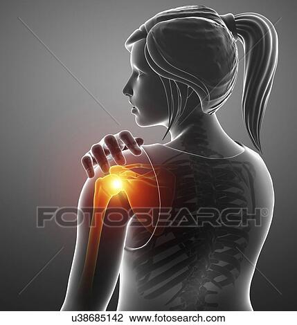 Woman with a painful shoulder, computer illustration. View Large Photo Image Stock Image - Woman with a painful shoulder, computer illustration.. Fotosearch
