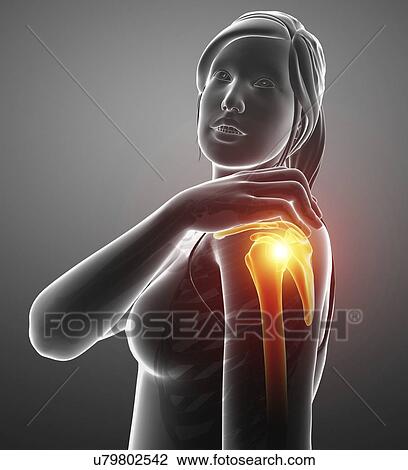 Stock Image - Woman with a painful shoulder, computer illustration.. Fotosearch