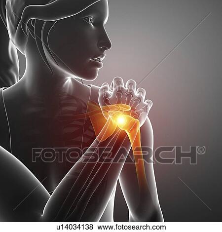 Woman with a painful shoulder, computer illustration. View Large Photo Image Stock Photo - Woman with a painful shoulder, computer illustration.. Fotosearch
