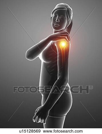 Stock Photo - Woman with a painful shoulder, computer illustration.. Fotosearch