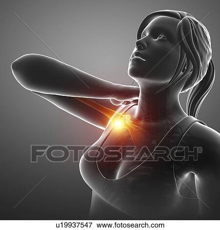 Stock Photo - Woman with a painful shoulder, computer illustration.. Fotosearch