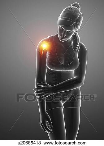 Stock Photo - Woman with a painful shoulder, computer illustration.. Fotosearch