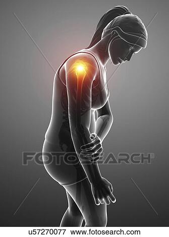 Stock Photo - Woman with a painful shoulder, computer illustration.. Fotosearch