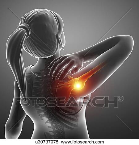 Woman with a painful shoulder, computer illustration. View Large Photo Image Stock Photography - Woman with a painful shoulder, computer illustration.. Fotosearch