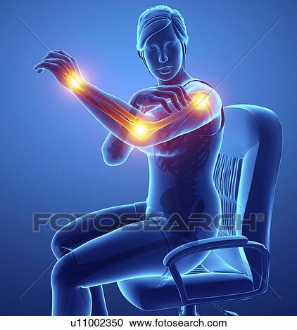 Woman with arm pain, computer illustration. View Large Photo Image Stock Image - Woman with arm pain, computer illustration.. Fotosearch