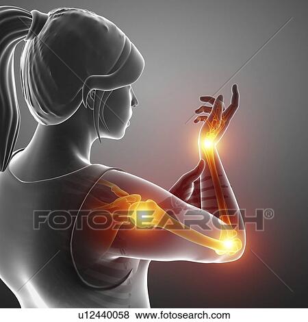 Woman with arm pain, computer illustration. View Large Photo Image Stock Photo - Woman with arm pain, computer illustration.. Fotosearch