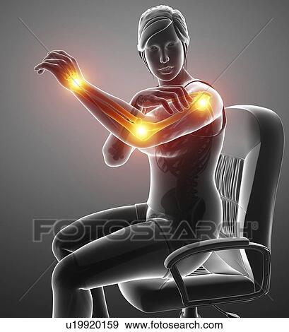 Woman with arm pain, computer illustration. View Large Photo Image Stock Photo - Woman with arm pain, computer illustration.. Fotosearch