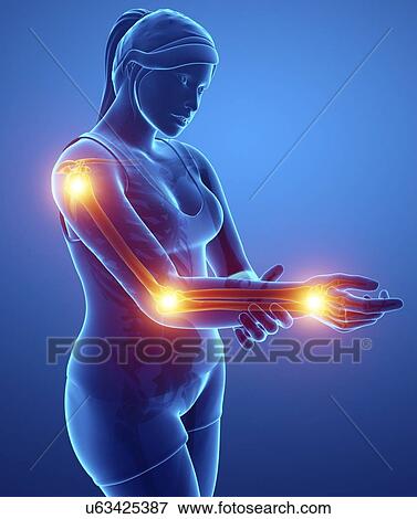Woman with arm pain, computer illustration. View Large Photo Image Stock Photo - Woman with arm pain, computer illustration.. Fotosearch