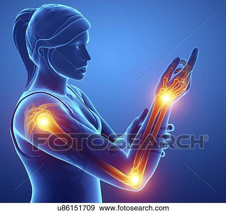 Woman with arm pain, computer illustration. View Large Photo Image Stock Photo - Woman with arm pain, computer illustration.. Fotosearch
