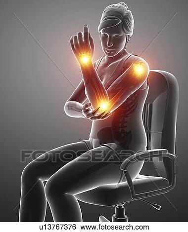 Woman with arm pain, computer illustration. View Large Photo Image Stock Photograph - Woman with arm pain, computer illustration.. Fotosearch