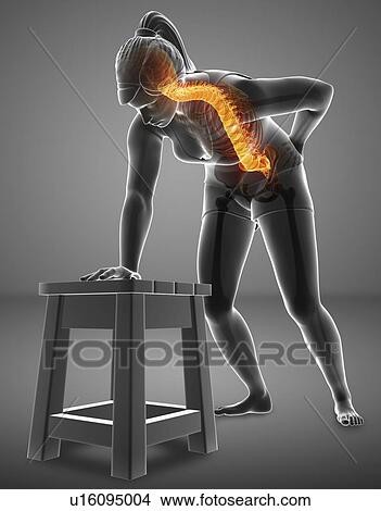 Picture - Woman with back pain, computer illustration.. Fotosearch