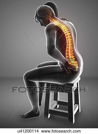 Picture - Woman with back pain, computer illustration.. Fotosearch
