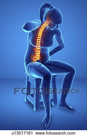 Woman with back pain, computer illustration. View Large Photo Image Stock Image - Woman with back pain, computer illustration.. Fotosearch