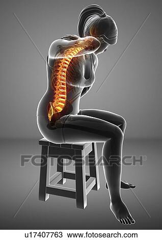 Woman with back pain, computer illustration. View Large Photo Image Stock Image - Woman with back pain, computer illustration.. Fotosearch