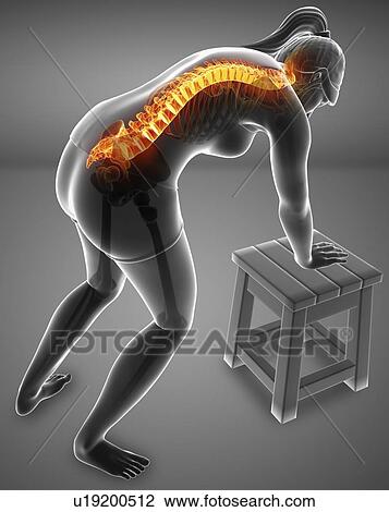 Woman with back pain, computer illustration. View Large Photo Image Stock Image - Woman with back pain, computer illustration.. Fotosearch