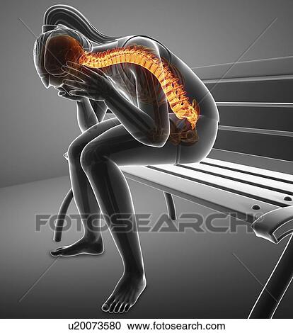 Woman with back pain, computer illustration. View Large Photo Image Stock Image - Woman with back pain, computer illustration.. Fotosearch
