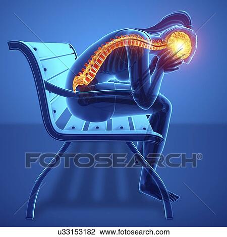 Woman with back pain, computer illustration. View Large Photo Image Stock Image - Woman with back pain, computer illustration.. Fotosearch