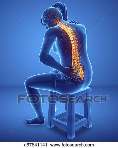 Woman with back pain, computer illustration. View Large Photo Image Stock Image - Woman with back pain, computer illustration.. Fotosearch