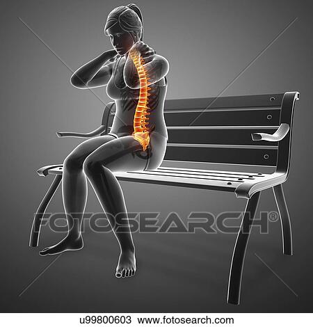 Woman with back pain, computer illustration. View Large Photo Image Stock Image - Woman with back pain, computer illustration.. Fotosearch