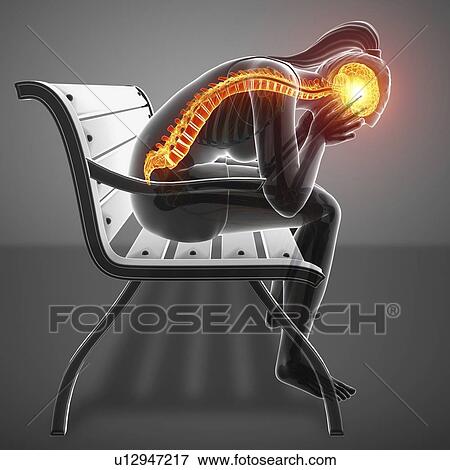 Stock Photo - Woman with back pain, computer illustration.. Fotosearch