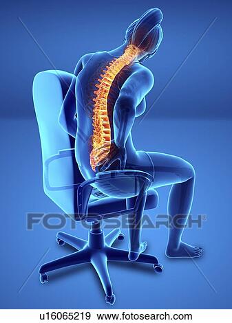 Woman with back pain, computer illustration. View Large Photo Image Stock Photo - Woman with back pain, computer illustration.. Fotosearch