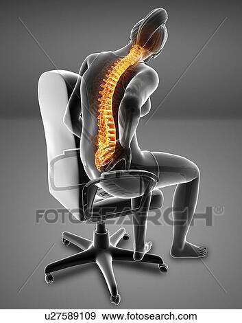 Woman with back pain, computer illustration. View Large Photo Image Stock Photo - Woman with back pain, computer illustration.. Fotosearch