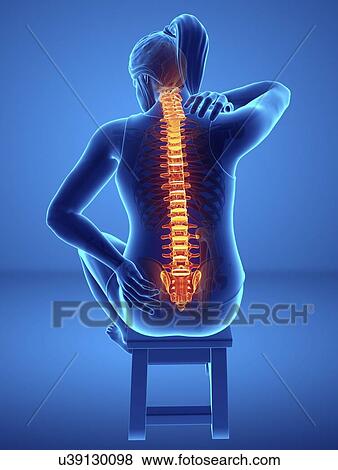 Woman with back pain, computer illustration. View Large Photo Image Stock Photo - Woman with back pain, computer illustration.. Fotosearch