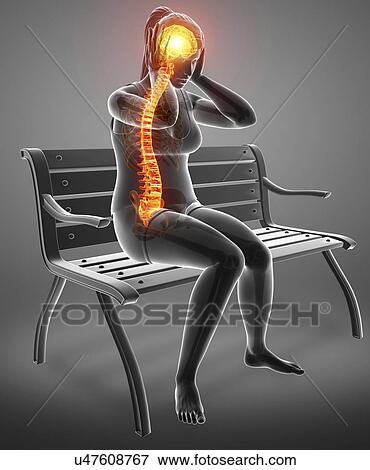 Woman with back pain, computer illustration. View Large Photo Image Stock Photo - Woman with back pain, computer illustration.. Fotosearch