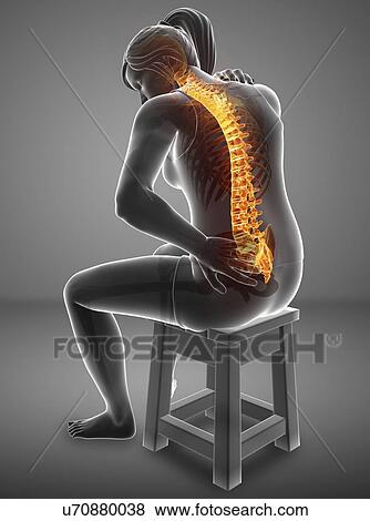 Woman with back pain, computer illustration. View Large Photo Image Stock Photo - Woman with back pain, computer illustration.. Fotosearch