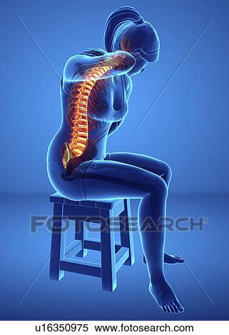 Stock Photography - Woman with back pain, computer illustration.. Fotosearch