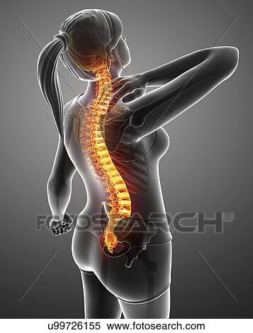 Woman with back pain, computer illustration. View Large Photo Image Stock Photography - Woman with back pain, computer illustration.. Fotosearch