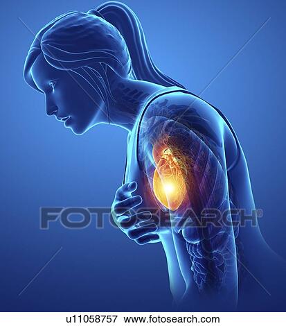Woman with chest pain, computer illustration. View Large Photo Image Stock Photo - Woman with chest pain, computer illustration.. Fotosearch
