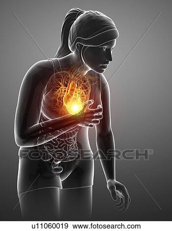 Woman with chest pain, computer illustration. View Large Photo Image Stock Photo - Woman with chest pain, computer illustration.. Fotosearch
