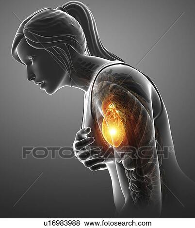 Stock Photo - Woman with chest pain, computer illustration.. Fotosearch