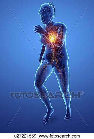 Stock Photo - Woman with chest pain, computer illustration.. Fotosearch