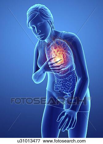 Woman with chest pain, computer illustration. View Large Photo Image Stock Photo - Woman with chest pain, computer illustration.. Fotosearch