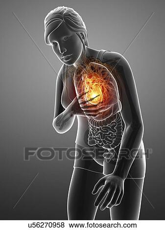 Woman with chest pain, computer illustration. View Large Photo Image Stock Photo - Woman with chest pain, computer illustration.. Fotosearch
