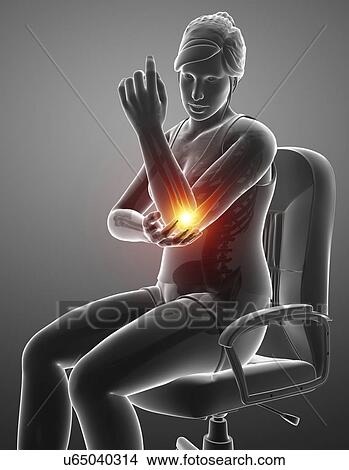 Picture - Woman with elbow pain, computer illustration.. Fotosearch