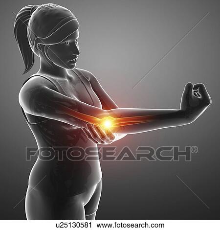 Stock Image - Woman with elbow pain, computer illustration.. Fotosearch
